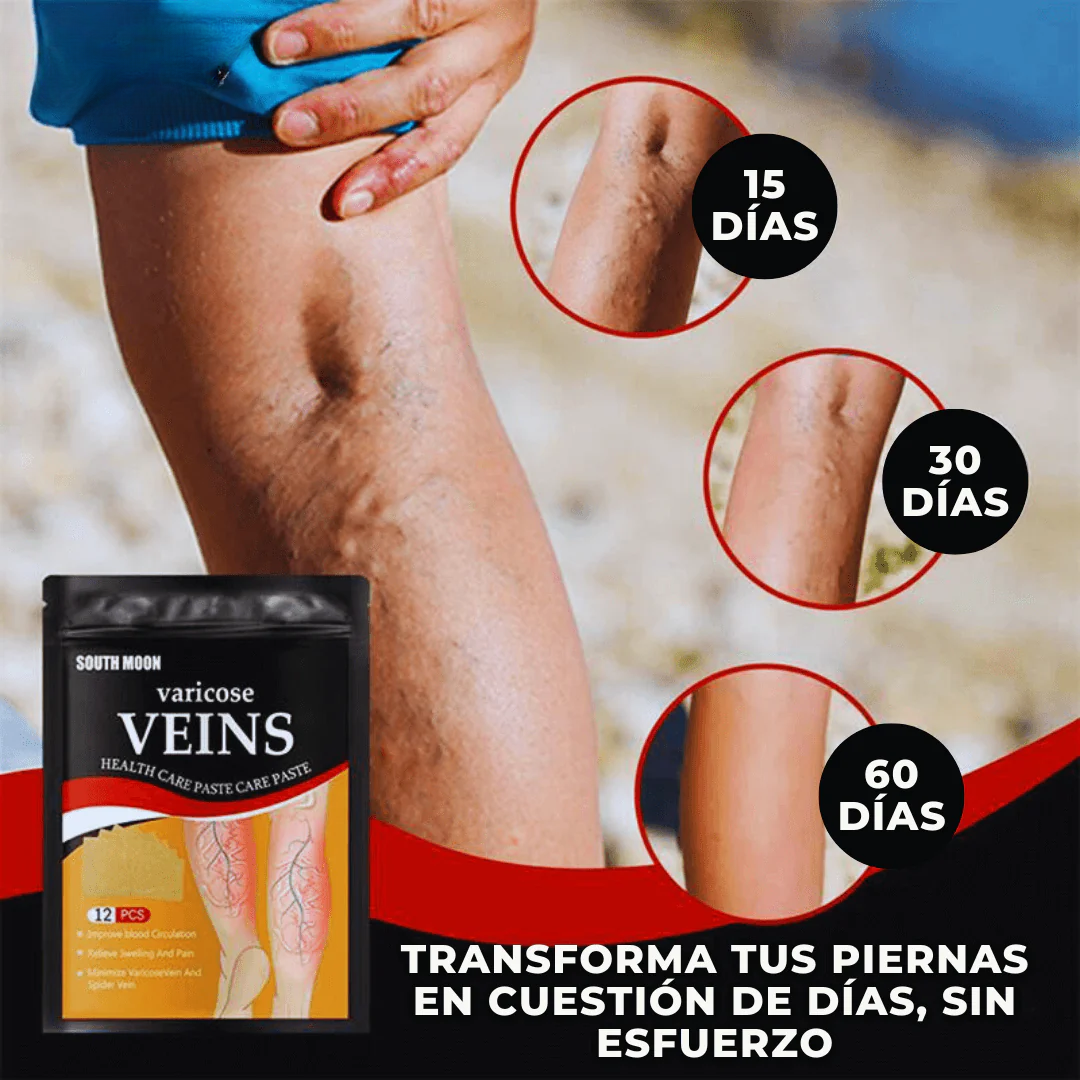 PARCHES PARA EL TRATAMIENTO DE VENAS VARICOSAS/VARICES (48 UNIDADES) + ENVIO GRATIS 💝